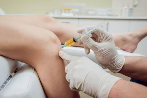 Hiệu quả và chỉ định của phương pháp tiêm PRP trong điều trị thoái hóa khớp