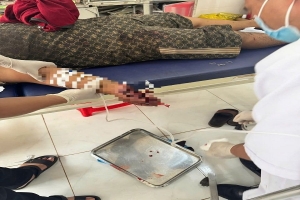 Điện thoại phát nổ khi đang sạc, thiếu niên 16 tuổi bị thương nặng ở hai bàn tay
