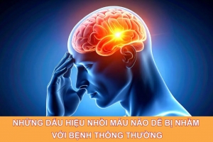 Những dấu hiệu nhồi máu não dễ bị nhầm với bệnh thông thường