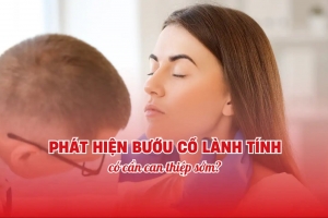 Phát hiện bướu cổ lành tính có cần can thiệp sớm?