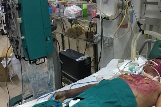 Tự điều trị thủy đậu, nam bệnh nhân bị suy đa phủ tạng