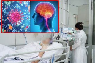 Cảnh báo sự trở lại của bệnh não mô cầu xâm lấn với nguy cơ tử vong nhanh trong 24 giờ