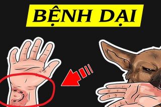 Hà Nội: Xuất hiện ổ dịch dại trên chó, cảnh báo mức độ nguy hiểm độ III từ các vết cắn