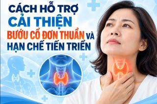 Cách hỗ trợ cải thiện bướu cổ đơn thuần và hạn chế tiến triển