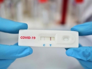 Bộ Y tế yêu cầu các cơ sở sản xuất, NK báo cáo giá bán test xét nghiệm Covid-19