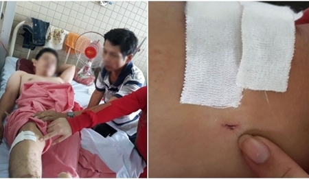 Vụ gãy đốt sống bị khoan nhầm cẳng chân: Đình chỉ công tác hai nhân viên y tế