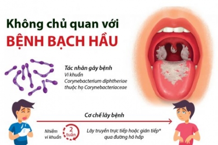 Lào Cai: Tăng cường công tác phòng, chống bệnh bạch hầu