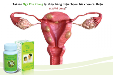 Tại sao Nga Phụ Khang được hàng triệu chị em lựa chọn cải thiện u xơ tử cung?