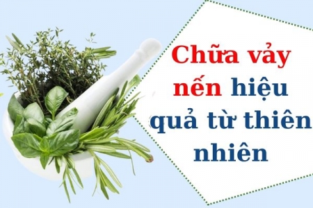 Top 7 cách chữa bệnh vảy nến tại nhà từ thiên nhiên hiệu quả