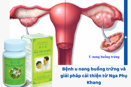 Bệnh u nang buồng trứng và giải pháp cải thiện từ sản phẩm thảo dược Nga Phụ Khang