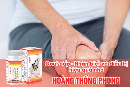 Gout cấp - Nhận biết và điều trị hiệu quả nhờ Hoàng Thống Phong