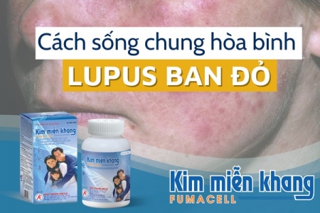 Lupus ban đỏ dạng đĩa và cách chung sống hòa bình với bệnh nhờ Kim Miễn Khang