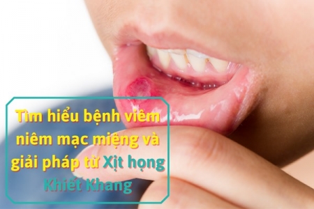 Tìm hiểu bệnh viêm niêm mạc miệng và giải pháp từ Xịt họng Khiết Khang