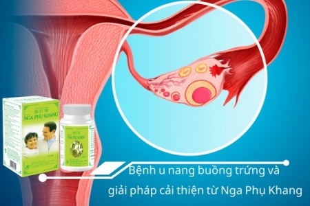 Bệnh u nang buồng trứng và giải pháp cải thiện từ Nga Phụ Khang