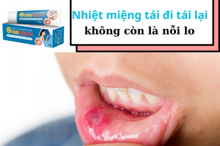 Nhiệt miệng tái đi tái lại không còn là nỗi lo nhờ Gumimouth