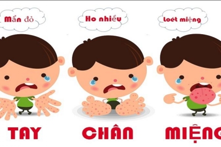 Bệnh chân tay miệng có chủng virus mới gây nguy hiểm tính mạng cho trẻ