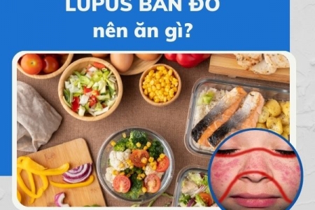 Bệnh lupus ban đỏ nên ăn gì? Uống Kim Miễn Khang được không?