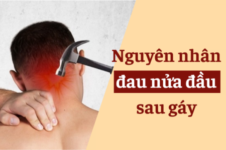 Nguyên nhân đau nửa đầu sau gáy và cách giảm đau hiệu quả với Bách Thống Vương