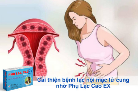 Cải thiện bệnh lạc nội mạc tử cung nhờ Phụ Lạc Cao EX