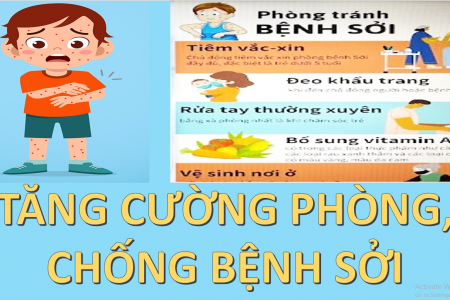 Thanh Hóa tăng cường công tác phòng, chống bệnh sởi