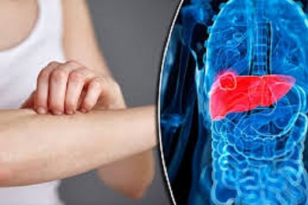 Sức khỏe tưởng chừng bình thường, nhưng sụt cân, vàng da báo hiệu ung thư gan giai đoạn cuối