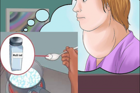 6 cách cải thiện bướu tuyến giáp an toàn và hiệu quả