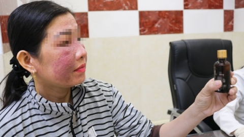 Tai biến, viêm da tiếp xúc kích ứng khi sử dụng mỹ phẩm làm trắng da cấp tốc