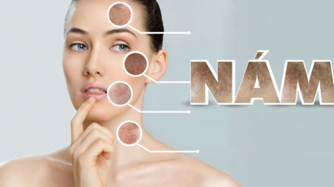 Giải pháp an toàn để giảm nám tàn nhang