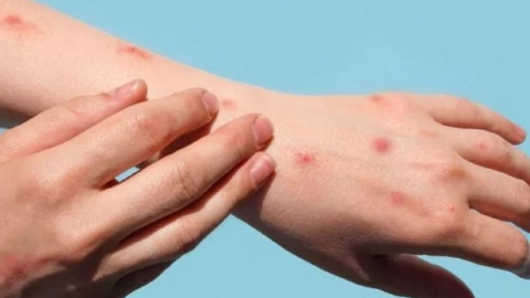 Trong 1 tuần TP. Hồ Chí Minh phát hiện thêm 15 ca đậu mùa khỉ
