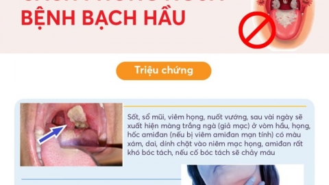 Công điện của Thủ tướng về tăng cường công tác phòng, chống bệnh bạch hầu