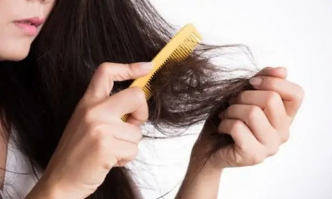 Rụng tóc nhiều tiềm ẩn tình trạng sức khỏe nghiêm trọng