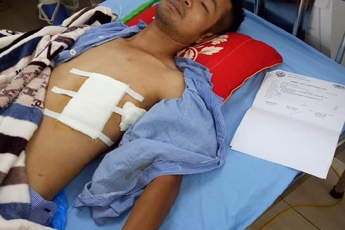 Bắc Giang: Nam thanh niên suýt mất mạng vì bị tấn công bằng súng, dao bầu?