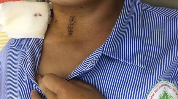 Yên Bái: Đang làm nương, thiếu nữ 17 tuổi bị đạn bắn trúng cổ