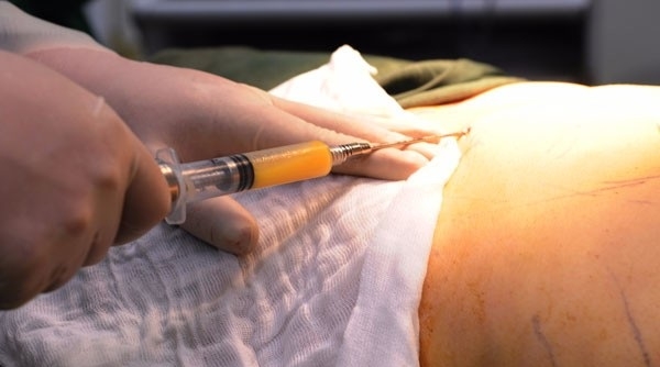 Một phụ nữ bị tử vong do hút mỡ bụng tại Bệnh viện Thẩm mỹ GANG WHOO