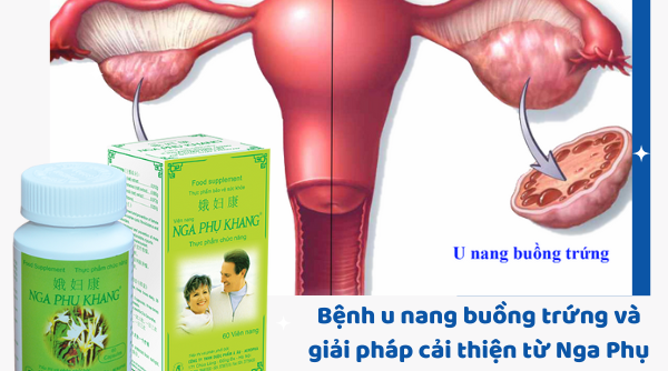 Bệnh u nang buồng trứng và giải pháp cải thiện từ sản phẩm thảo dược Nga Phụ Khang