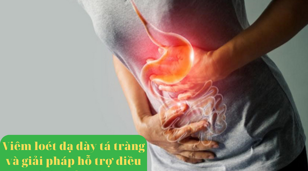 Viêm loét dạ dày tá tràng và giải pháp hỗ trợ điều trị từ thảo dược