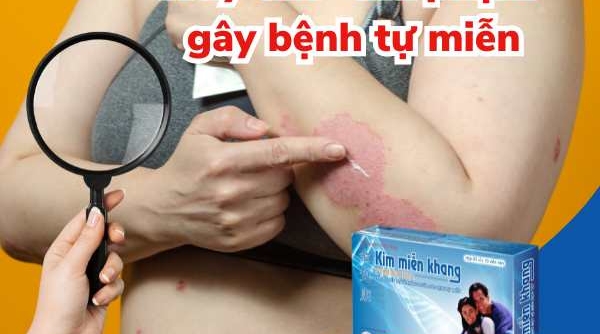 Truy tìm “thủ phạm” gây bệnh tự miễn và giải pháp đẩy lùi từ Kim Miễn Khang