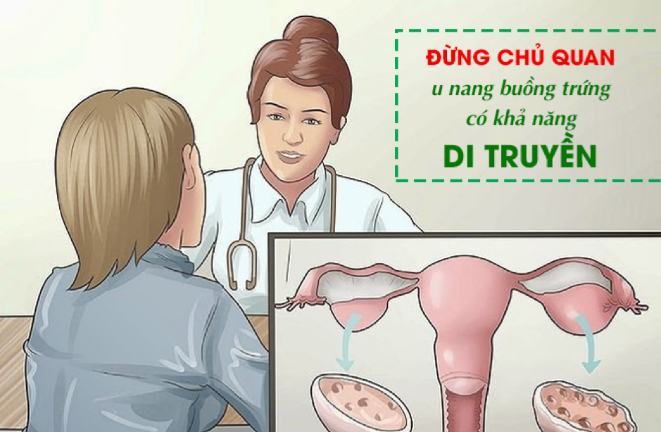 U nang buồng trứng là bệnh lý có tính di truyền