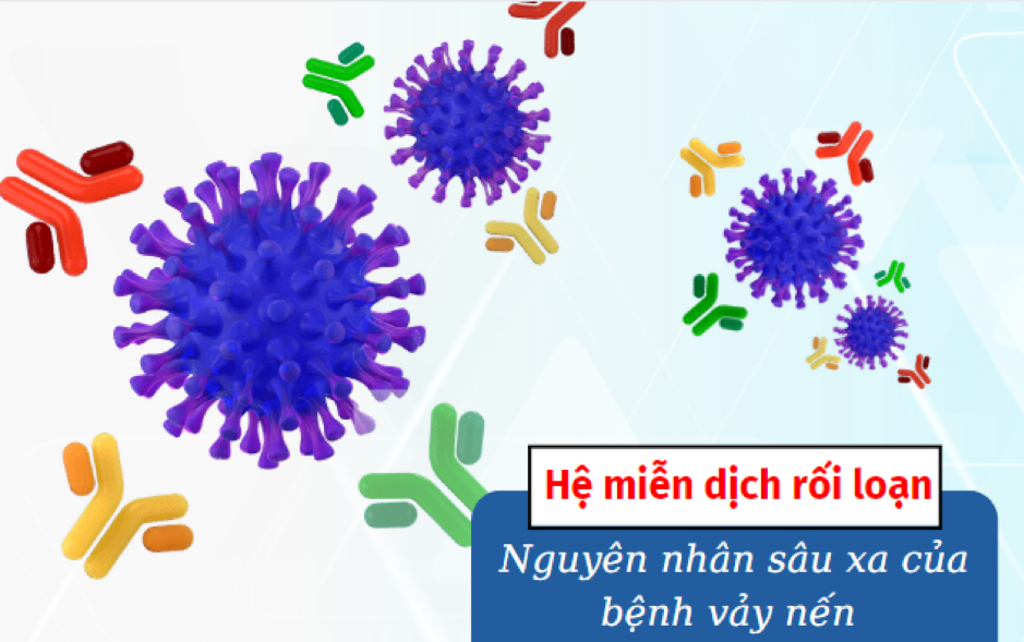 Vảy nến có liên quan tới rối loạn miễn dịch