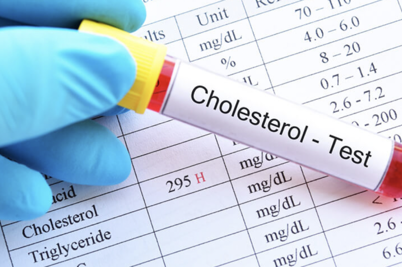 Xét nghiệm lipid máu để chuẩn đoán rối loạn lipid máu