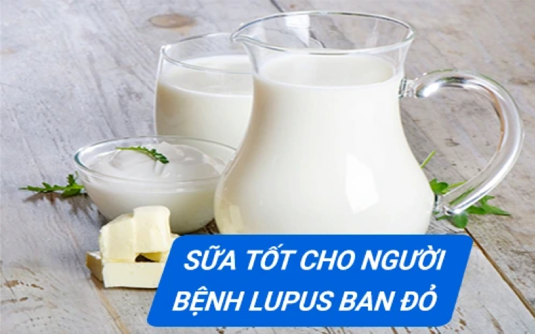 Sữa chứa nhiều canxi tốt cho người bệnh lupus ban đỏ