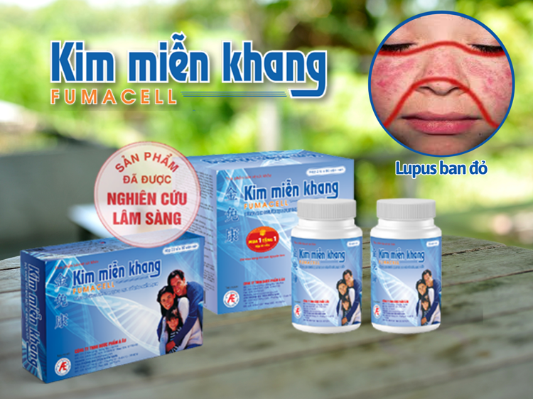 Kim Miễn Khang giúp cải thiện bệnh lupus ban đỏ hiệu quả