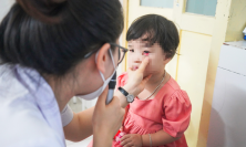 Bộ Y tế yêu cầu giám sát và không để thiếu thuốc bệnh đau mắt đỏ