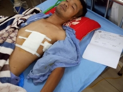 Bắc Giang: Nam thanh niên suýt mất mạng vì bị tấn công bằng súng, dao bầu? Bắc Giang: Nam thanh niên suýt mất mạng vì bị tấn công bằng súng, dao bầu?