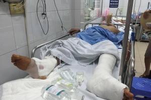 Tại Bệnh viện Việt Đức: Hội chẩn chân trái, mổ nhầm sang chân phải