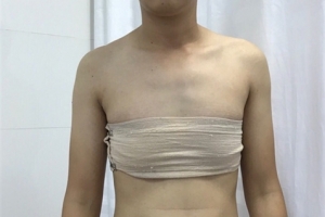 Việt Nam sắp thực hiện ca phẫu thuật chuyển giới