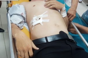 Đâm trọng thương thầy giáo vì bị nhắc nhở hình xăm trên cổ