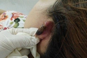 Bình Phước: Không trả nợ, cô gái bị chích điện, cắt tai