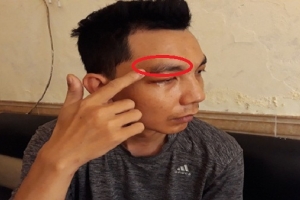 Cán bộ Công an phường Yên Hòa(Hà Nội) bị tố đánh người tại trụ sở?