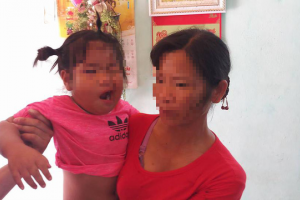 Cháu bé bị méo miệng nghi do cô giáo đánh, cơ quan chức năng nói gì?